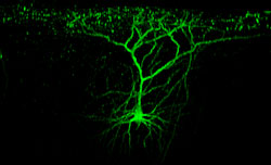 two-photon microscope image of a layer nerve cell in the visual cortex of a mouse